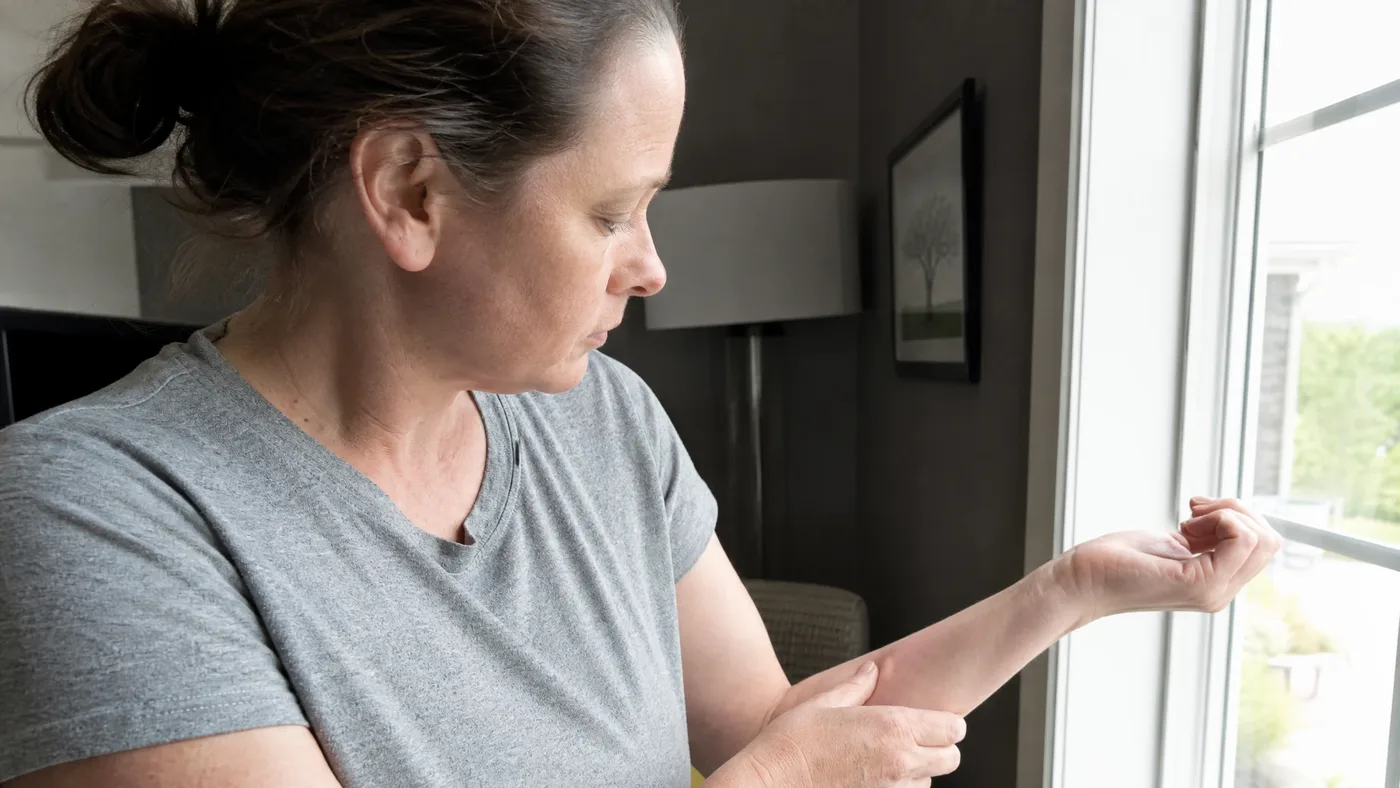 Cilantro Oil Skin Sensitivity: Irritation vs Allergy Explained